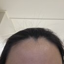 수북좋은약국 | 비오틴 추천, 이거 모르면 손해! 제가 고른 찐템은?