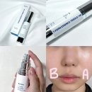 데일리 모공탄력케어 바이오아 T-PDRN 에센스 티들샷 100 민감성 피부 사용후기