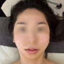 홍대전철역 4번출구 | 홍대 데콜테 마포 피부관리샵 가인미가 신촌 얼굴축소관리 리얼후기