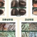 도노포레스타
