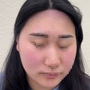 모모헤어라인 이미지