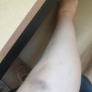 덕천정비공업사 | 셀프교통사고 후기/자보한의원/교통사고휴유증