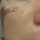 (주)리치 | 고분자 히알루론산의 강력 수분앰플 이런날엔 히알루론 앰플 리치 추천 후기