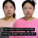 몸사랑피부연구소 | 목동 피부관리 쏘영피부연구소에서 비대칭 한 번에 잡는 얼비몸비 두골비 관리 솔직 후기!
