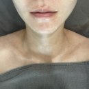 수원피부관리 가은에스테틱 후기, 데콜테 관리가 진짜였던 피부관리