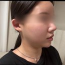 달구벌대로174길 | 대구 다사 윤곽관리 제대로 받고 온 후기 ㅣ 끌림인 뷰티 워터에어 윤곽관리 솔직 리뷰