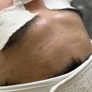 현인메디칼 | 강남에스테틱 에스텔뷰티 뉴페이스 3주 프로그램 3주차 재생관리