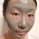 장희스킨케어 | 피부색소침착레이저 판도 바뀐다 장희빈미안법으로