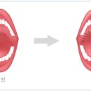 법인두그린 이미지