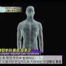 세상에서 가장 고통스러운 병, CRPS (약스압)＜신동욱이 걸린병＞.jpg 이미지