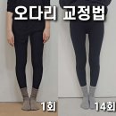 오다리 교정 실제후기와 운동법 (소녀시대 윤아 오다리교정)