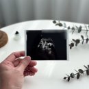 케이앤씨메드(K&C메드) | 산모 임산부 영양제 시기 종합비타민 이지맘 스텝2