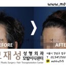 모재성성형외과의원 이미지