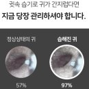 강동하나이비인후과의원 이미지