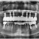 바른정치과의원 이미지