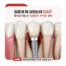 힘들게 해 넣었는데 다시? 재수술 위험 큰 ‘임플란트 주위염’ 관리 이미지