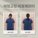 (주)아성다이소 부평역남부점 | 부평역 필라테스, 골반 비대칭 교정 후기