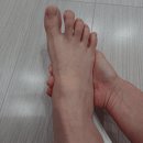 “스트레스때문 아니었다” 몸 전체에 염증이 퍼지면 생긴다는 ‘최악의 증상’ 이미지