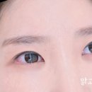 제로메디 이미지