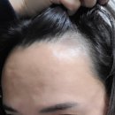 스칼프디자인센터 홍대점 이미지