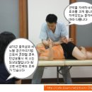 견관절 허리 통증시 삼각근 비노혈 치료 이미지