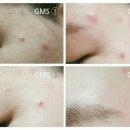 지엠에스(GMS)