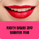 노원플러스치과의원 이미지