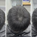 일산두피&눈썹단미토탈뷰티