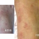 에버노블 이미지