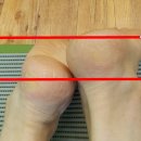 에이치 LAB 이미지