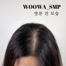 우와하게 | 부천 탈모 두피커버 전문 우와하게 | 20대 여성탈모 완벽하게 고민 해결!