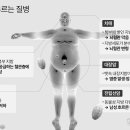 뱃살 그대로 두면 생기는 ‘치명적인’ 몸의 변화 5가지 / 헬스조선 이미지