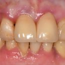 은혜치과기공소 이미지