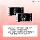 노즈랩의원 네이버블로그