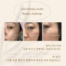 [공지] 기미·잡티 고민이라면? 지금이기회! 도테라보고 살루벨 구매 시 로즈터치 선물! 온가드소프트젤...