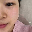오투엘 | [마산 피부관리] 마산 롯데캐슬 근처 기미 잡티 흑자 색소 피부관리 잘하는 &#34;수뷰티&#34; 방문 후기