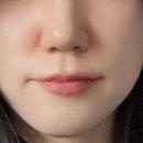 봄눈피우다의원