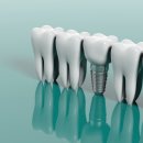 미소연치과의원 이미지