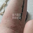 의료법인부여의료재단 부여다사랑병원 | [정보 전달] 마산·창원 지역 지연성 알러지 검사 가능 병원 안내