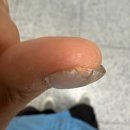 노가 | 청라 네일 랑띠에 | 물어뜯는 손톱 교정 노가 아크릴 &amp; 습식 케어 후기