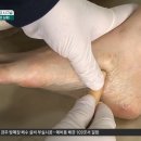 발은 신체의 축소판🦶🏻 허리 통증엔 &#39;이 부위&#39;를 꼭 지압하세요! | 행복한 아침 944 회 이미지