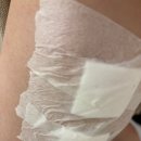 행복한 골프클리닉 | 수원 광교 요즘 핫한 비만클리닉 지방분해주사 결혼 전 몸무게 성공 내돈내산 후기