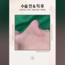 로웰성형외과의원 이미지