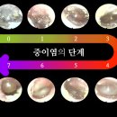 뉴톤보청기 광주지사 이미지