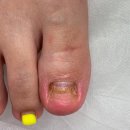 레푸스&아트포레 이미지