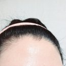 메디코스 | 피부레이저 후 관리 메디코스 프로포뮬라 재생크림 추천!