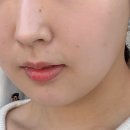 비(B):결에스테틱 | 강동구피부관리 [고은결에스테틱] 강동역트러블 여드름케어 만족후기