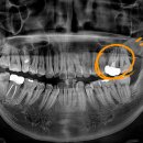 미소지은치과의원 이미지