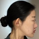 멍발머리 이미지