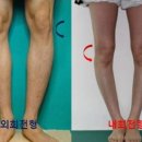 꿀체형관리 이미지
